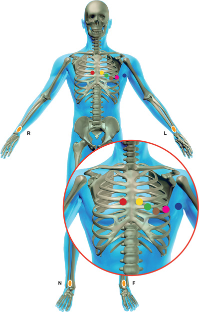 Skelton showing correct placement for ECG leads